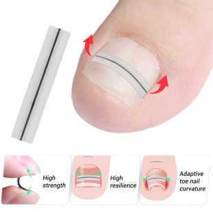 Titanium alloy fourth generation plastic coated steel wire nail paste bionic bone paste steel wire steel sheet nail paste correction patch