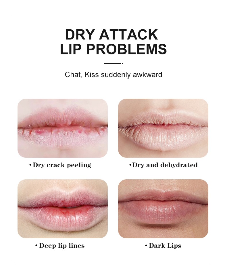 Fruit-Flavored Lip Balm Set 3