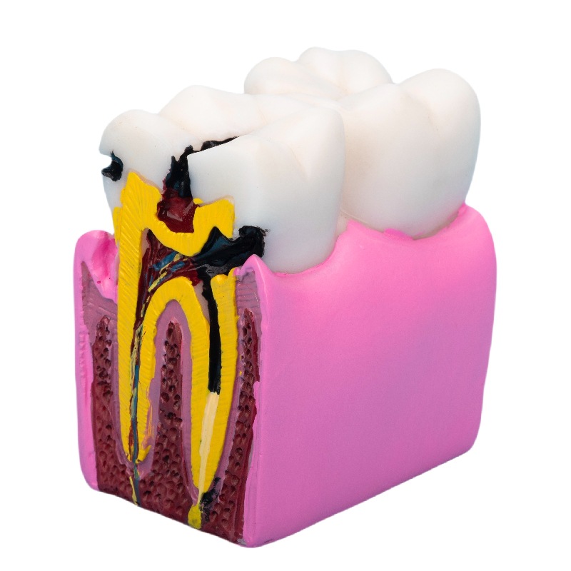 Oral Hospital Doctor-Patient Communication Teaching Model, Dental Bilateral Comparison Display, Denture Teaching Mold Ornaments