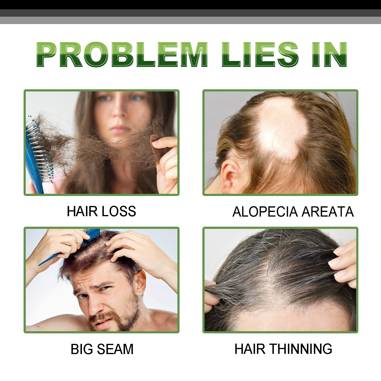 OUHOE Growth Kräuteressenz Feuchtigkeitsspendende, straffende, dichte Haarpflege_voghion.com