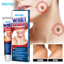 ERAYCEE羳Rdվuc skin tag removerƽ