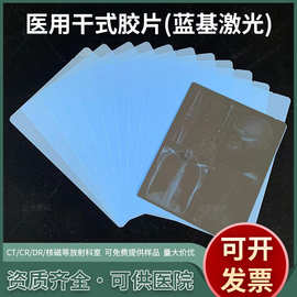 13*17医用蓝基喷墨胶片 医用X光胶片激光胶片放射科打印胶片厂家