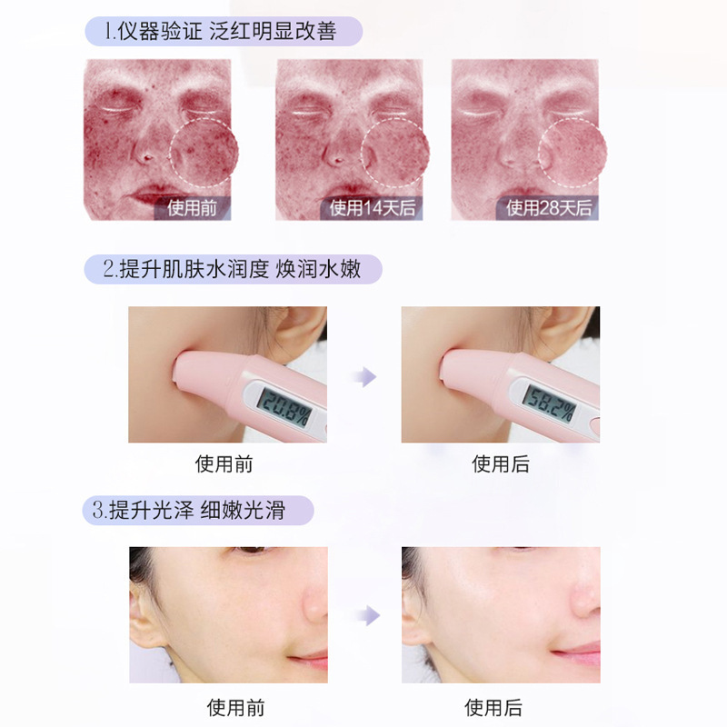 韦雪同款韩国奶皮面膜修护敏感肌舒缓修护紧致抗皱人皮涂抹面膜|undefined