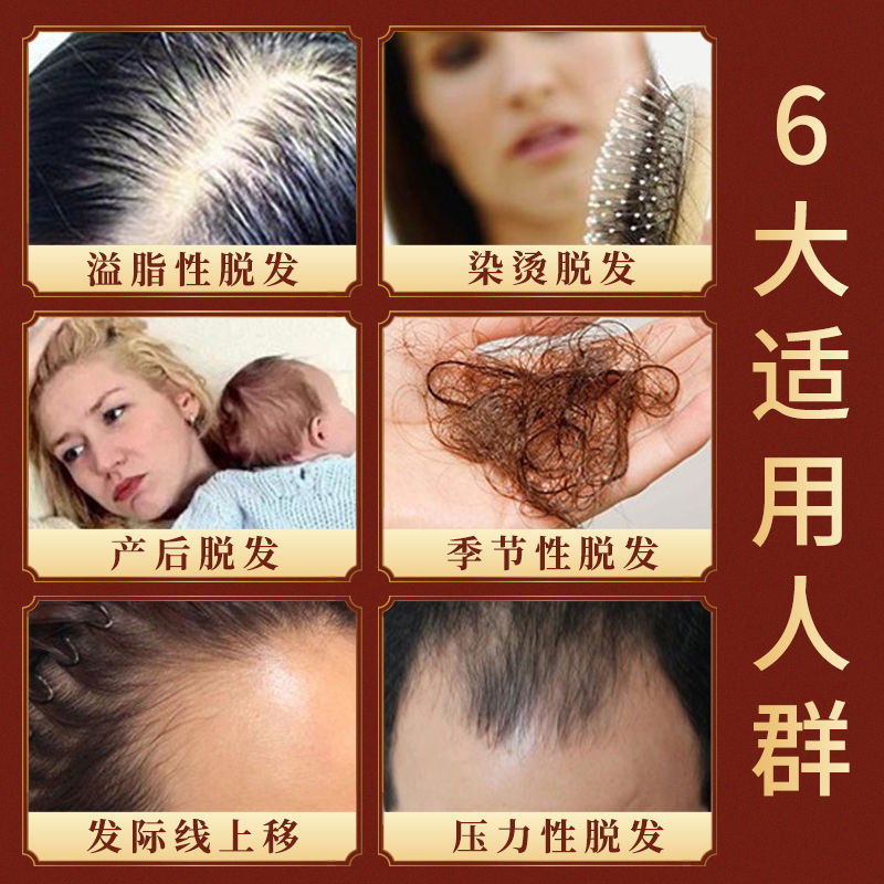 何首乌育发液生头发液头发猛长修复毛囊保湿发际线防脱固发剂精华|undefined