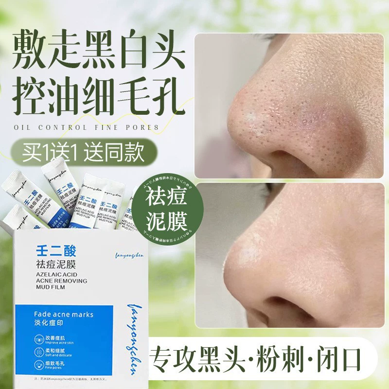 Маска из грязи от прыщей сужает поры, контролирует выделение жира, увлажняет и питает кожу, склонную к жирности и чувствительность, уменьшает следы акне, восстанавливает и контролирует выделение жира, устраняет акне.