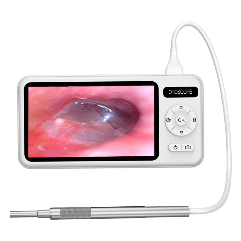 Визуальный эндоскоп для ушей 5-дюймовый HD с экраном Визуальный отоскоп для ушей Специальный визуальный ушной совок для захвата ушей полости рта