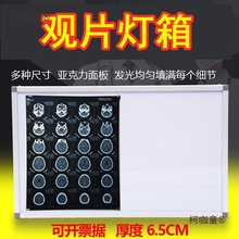 观片灯箱超薄X光led看片三联双联单联牙科阅片LED骨科四联麦太保