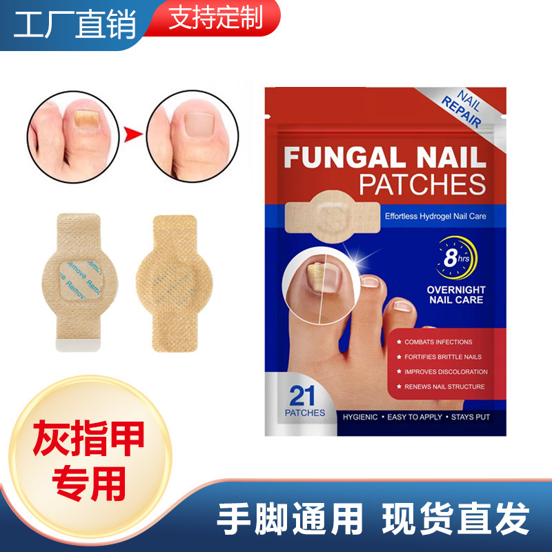 Paste de uñas transfronterizas, fijación, prevención de suciedad, reparación de uñas grises, cuidado de los pies, inflamación de la fossa de las uñas, paste antibacteriano, paste protector de uñas de los dedos de los pies