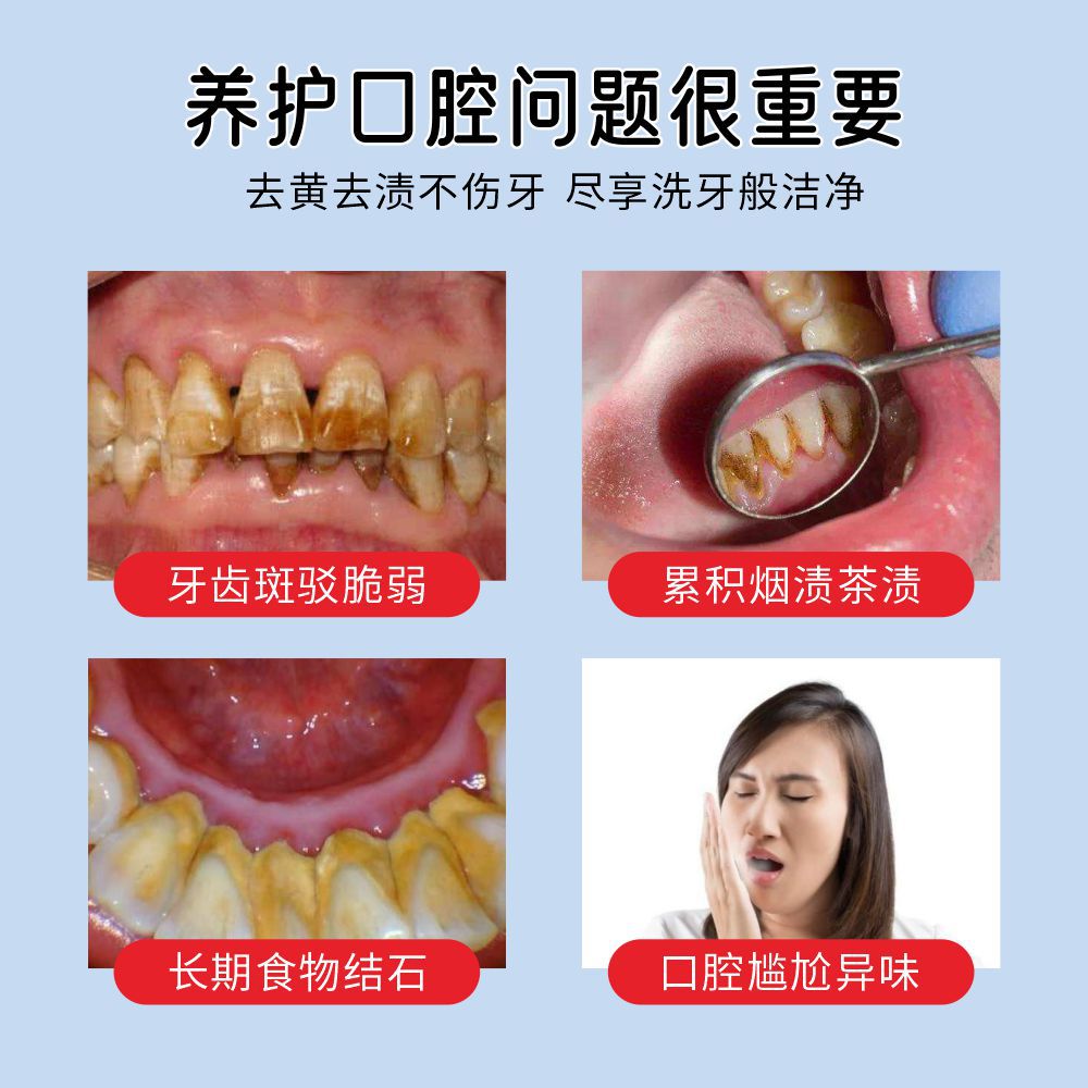 牙結石噴霧口臭去除漱口水噴劑口腔香港大藥房溶解噴霧清潔牙漬
