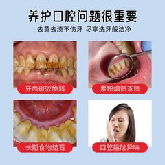 牙結石噴霧口臭去除漱口水噴劑口腔香港大藥房溶解噴霧清潔牙漬