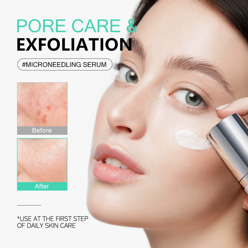 Эссенс KOEC Cica Centella Microneedle, увлажняющий успокаивающий осветляющий, 50 мл