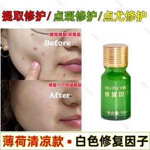 Beauty Salon Repair Factor Spot Spot Mole Repair Peptide Microneedle Extraction Broken Skin Redness Reduction Phellodendron Repair Cream Epidermal Cream