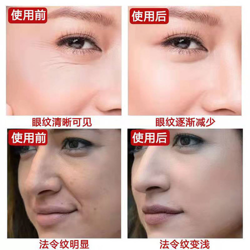 Collagen Filling Cream Wrinkle Firming Cream Repairing Moisturizing Anti-Wrinkle Rejuvenating Cream Collagen Restructuring Cream