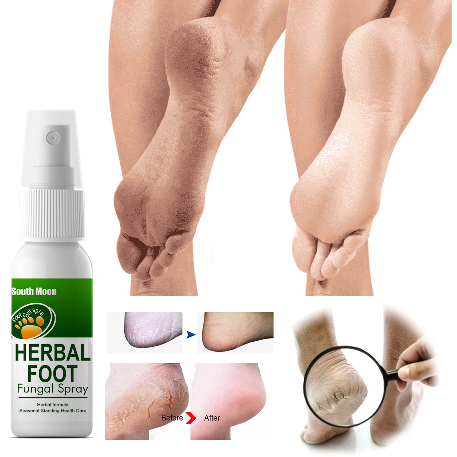 Herbal spray Sweat, Odor and Itch Relieving Foot Care Spray_voghion.com
