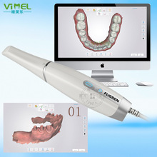菲森口腔三維掃描儀口內模型正畸修復3D取模不用噴粉牙科口掃儀