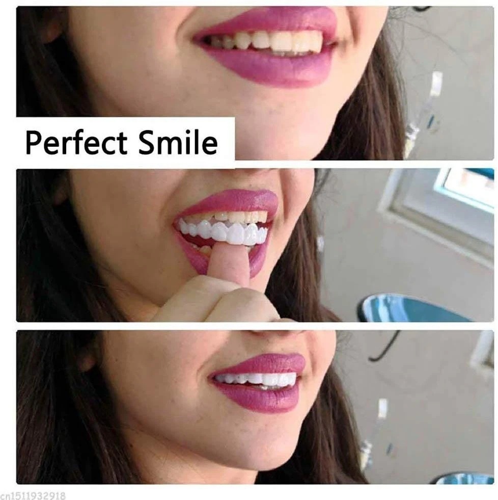 Snap-On Smile Image 5