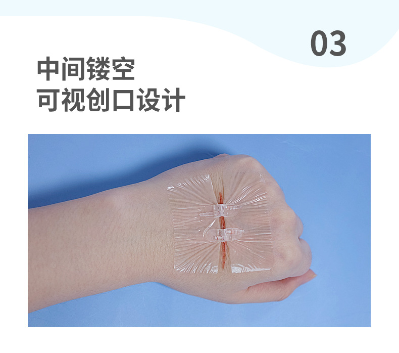 弘生减张器免缝合伤口缝合器 无纺布拉链式创口贴 皮肤减张吻合器-阿里巴巴