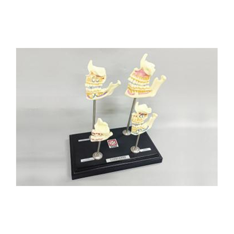 Modelo de simulación dental simple de modelo de práctica de enseñanza oral tipo reposacabezas modelo de cabeza simple de sujeción de mesa modelo de simulación de cabeza image 22