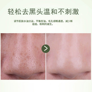 Blackhead Removal Liquid for Professional Use, Deep Cleansing Acne Purifying Pore Softening Exfoliating Pore Shrinking Essence