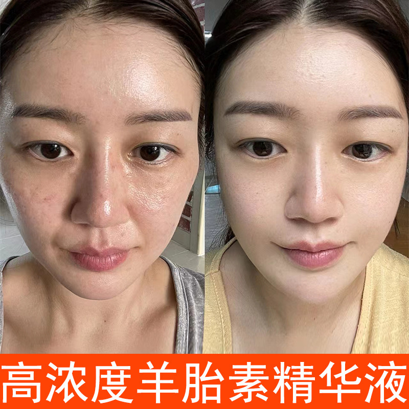 羊胎素抗初老精華液は引き伸ばして薄くします。|undefined