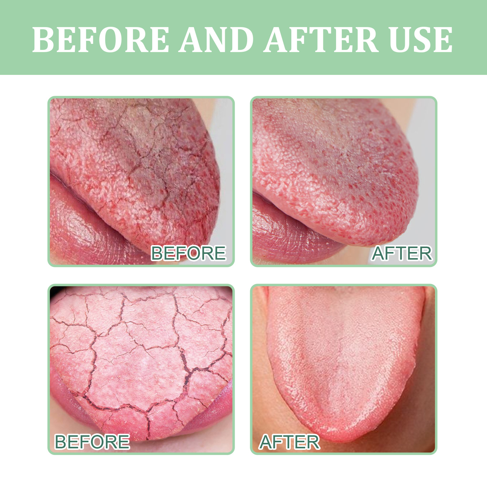 Relieve Cracked Tongue Fresh Breath Odor Eliminating Oral spray_voghion.com