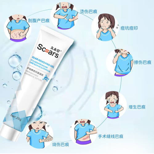 Jiumutang scar repair cold compress gel to fade acne pits, marks, and embroidery cream herbal scar repair cream to remove scars