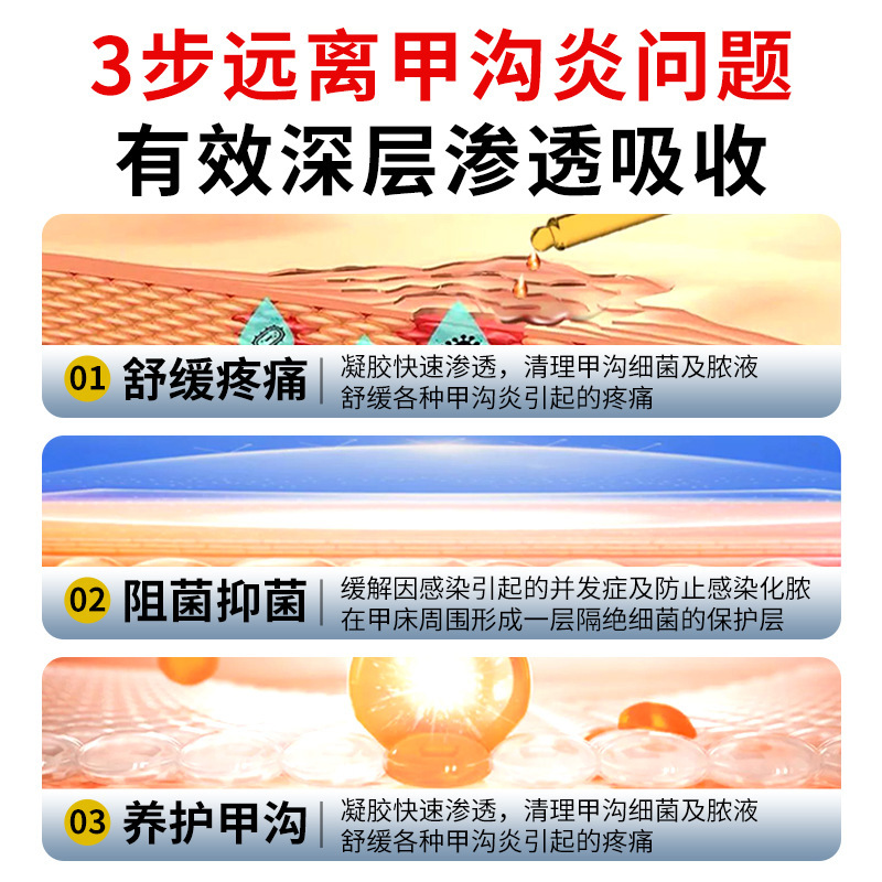 南京銅仁堂爪真菌症爪周囲炎爪肥厚除去爪明るい爪真菌症抗菌液体ネイルボックス家庭用医療|undefined
