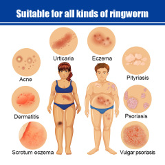 South Moon皮膚止癢干癢騷癢皮廯濕珍痱子膏外用塗抹皮膚護理乳膏