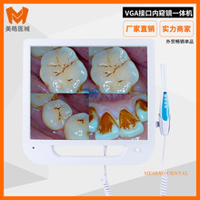 VGA口腔观察仪高清摄像拍照检查牙工具17寸WIFI牙科内窥镜一体机