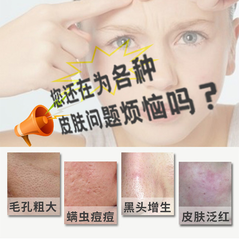 碧芙曼繭殼皂蠶絲拉絲皂除蟎控油洗臉皂去粉刺黑頭潔面羊奶手工皂