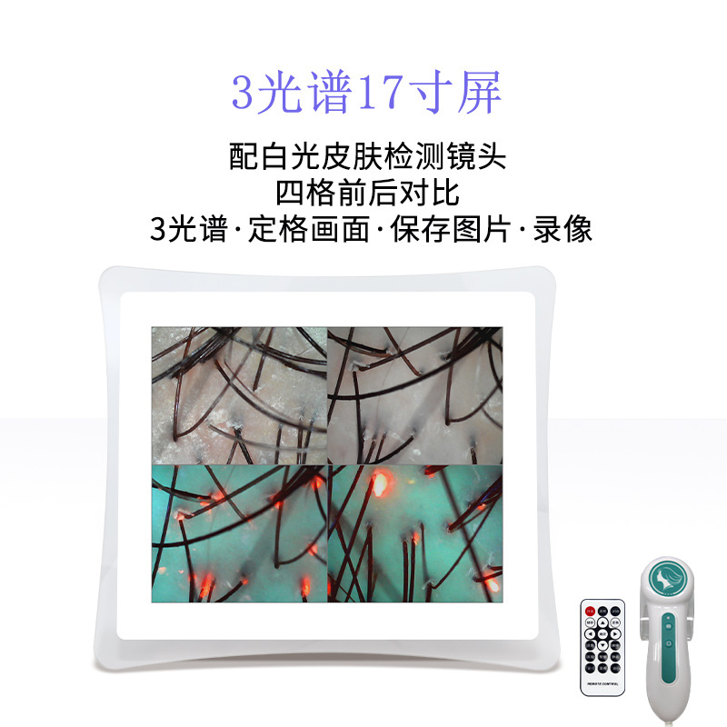 17 인치 대형 화면 감지기