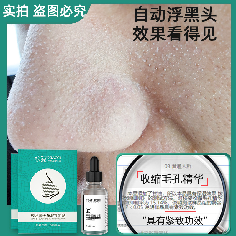 Nasal strips from black spots