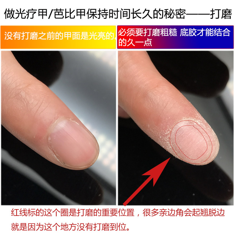 ネイルサロン専用のスポンジの爪を磨いて光を治療します。|undefined