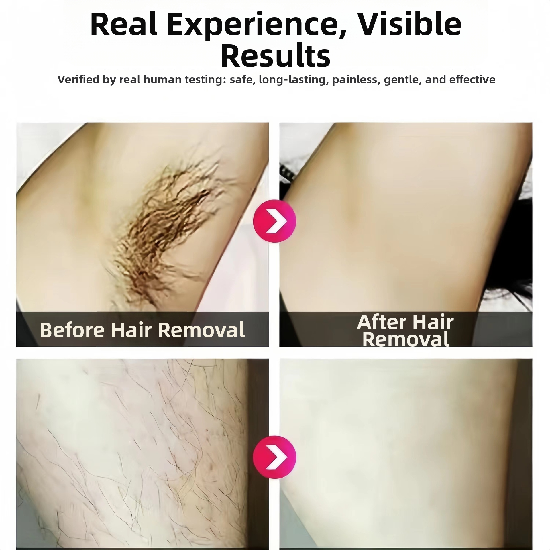 Home Laser Hair Removal Device IPL Portable Card Box Painless Full Body Shaver For Export Supply Personal Care Appliance_voghion.com