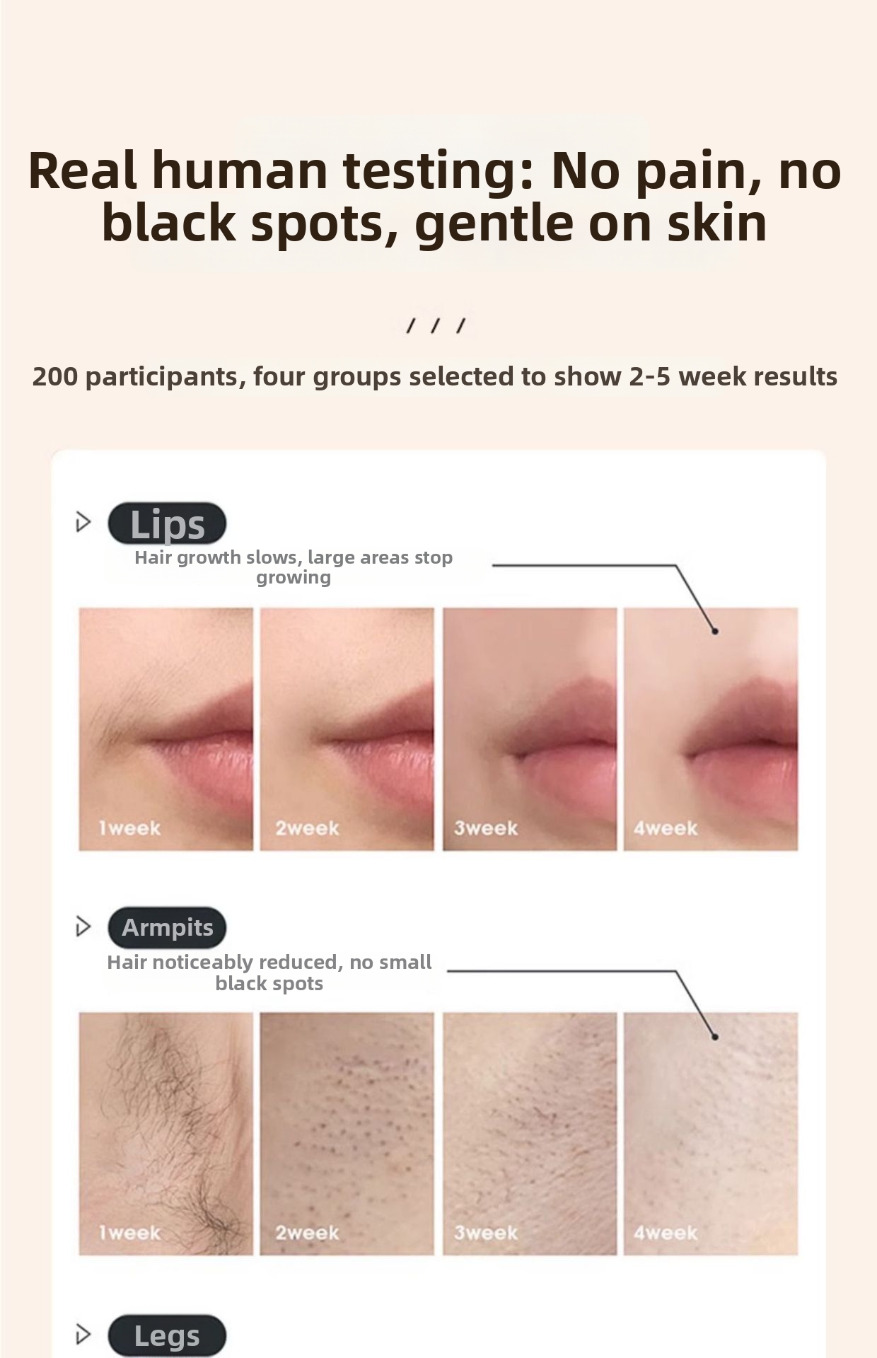 Aparelho de depilação a laser Ice Point Sapphire - Tratamento indolor para todo o corpo, ideal para uso doméstico, adequado para salões de beleza, axilas e genitais._voghion.com