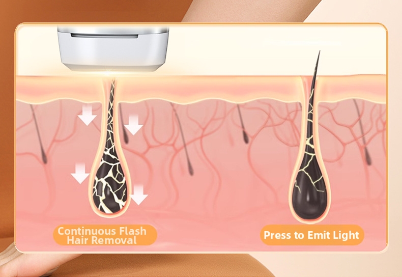 Aparelho de depilação a laser Ice Point Sapphire - Tratamento indolor para todo o corpo, ideal para uso doméstico, adequado para salões de beleza, axilas e genitais._voghion.com