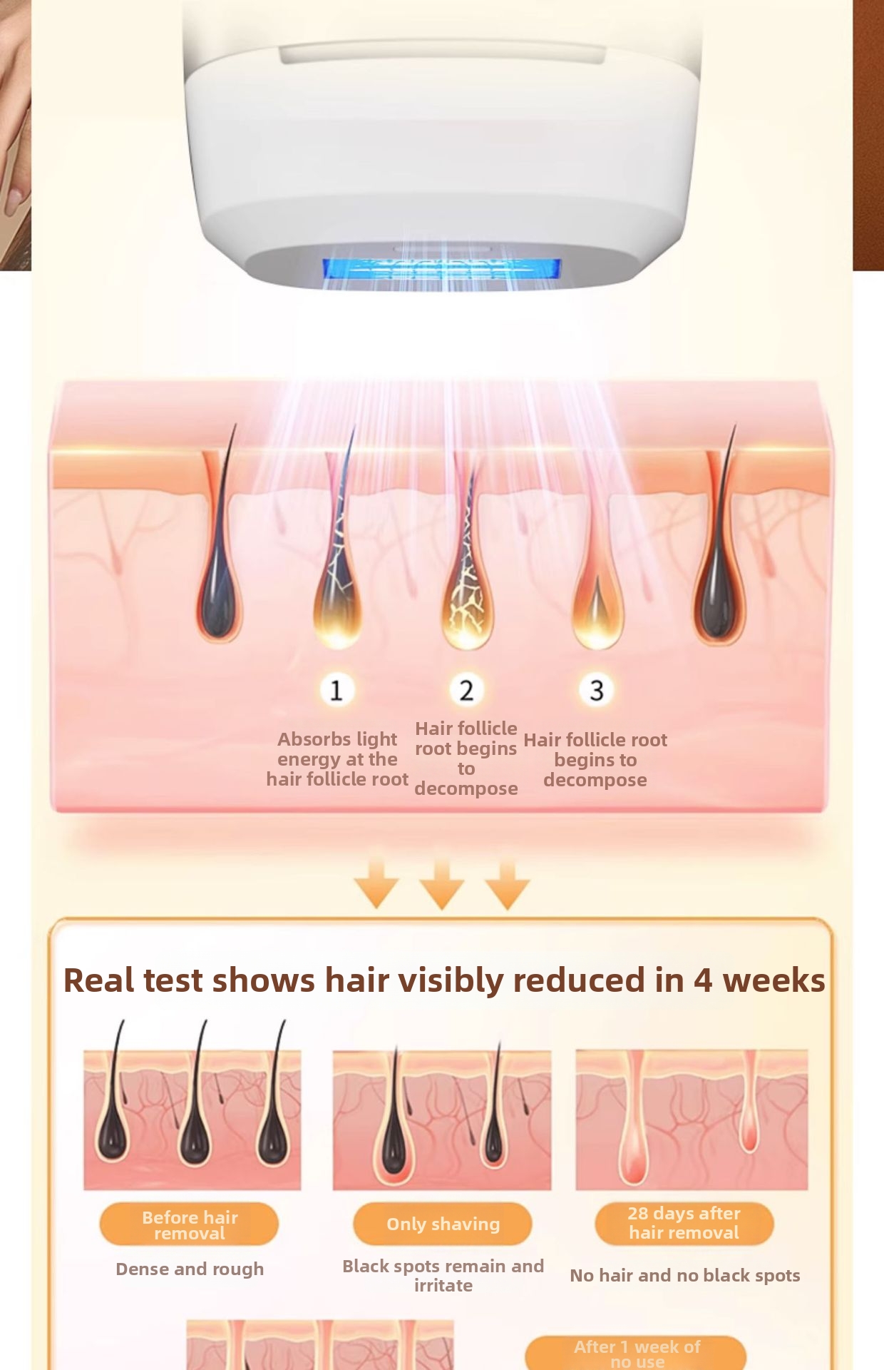 Aparelho de depilação a laser Ice Point Sapphire - Tratamento indolor para todo o corpo, ideal para uso doméstico, adequado para salões de beleza, axilas e genitais._voghion.com